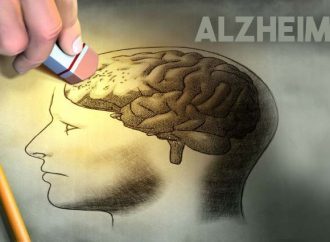 Alzheimer: redes sociais, filmes e séries ajudam pacientes a identificar sintomas da doença.