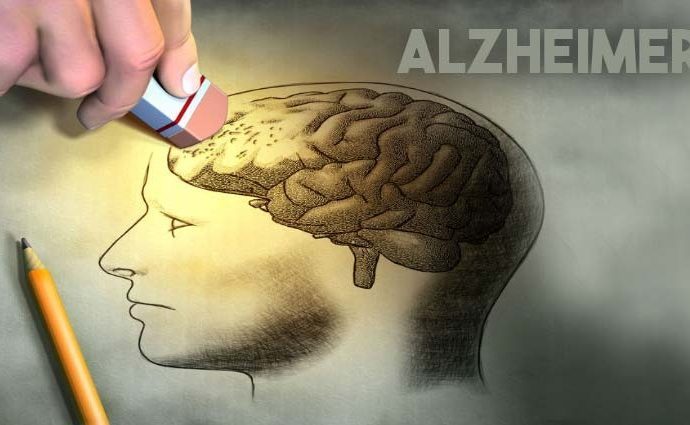 Alzheimer: redes sociais, filmes e séries ajudam pacientes a identificar sintomas da doença.